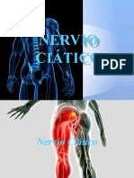 Nervio Ciatico