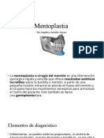 Mentoplastia: Cirugía del mentón para armonizar el rostro