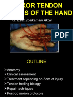 Flexor Tendon Injuries of the Hand: Repair and Rehab