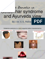 Goldenhar Syndrome