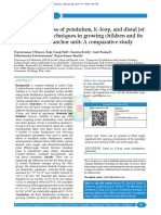 The Effectiveness of Pendulum K-Loop and Distal Je