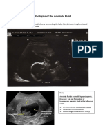Pathologies of The Amniotic Fluid: Gyneco Naji Hajj