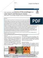 Verrucous Carcinoma of The Esophagus: A Case Report and Literature Review