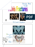 Pelvic Fracture