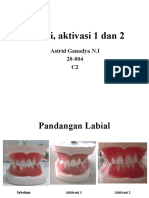 Insersi, aktivasi 1 dan 2 untuk pandangan labial, bukal, oklusal