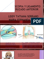 Artroscopia y Ligamento Cruzado Anterior