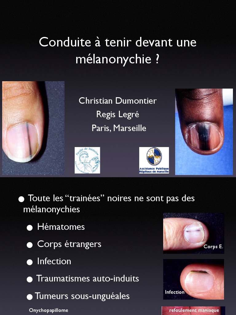 Petromax Marmite A Feu Ft1 Avec Pieds Noir