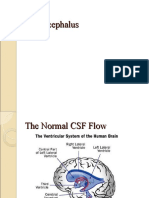 Hydrocephalus 1