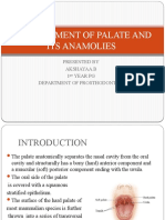 Development of Palate and Its Anamolies
