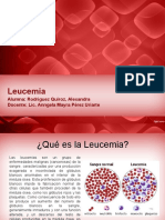 Leucemia