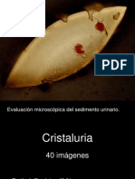 Evaluacion de Cristaluria