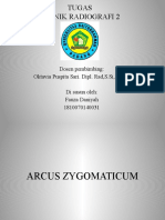 Arcus Zygomaticum TR2