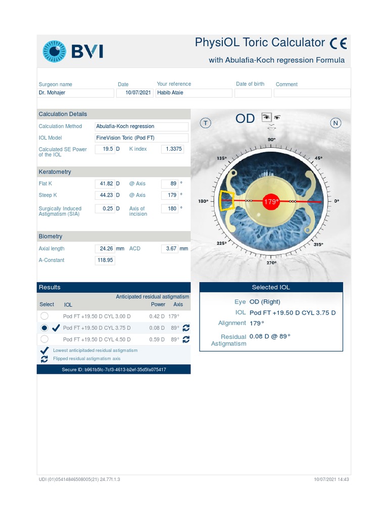 Toric Calculator Right Od , Calculator · Toric Calculator – KOSFY