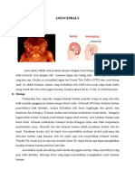 ANENCEPHALY