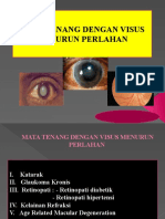 Mata Tenang Visus Turun Perlahan