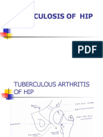 Tuberculosis of Hip Joint