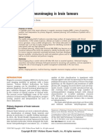 Update On Neuroimaging in Brain Tumours: Review