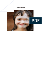 Down Syndrome Facts and Information