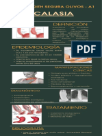 Acalasia: Definición, Epidemiología, Manifestaciones y Tratamiento