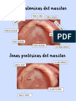 Zonas Anatómicas y Protésicas