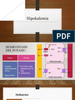 Hipokalemia