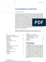 Paragangliomas Temporales