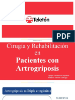 Artrogriposis 2