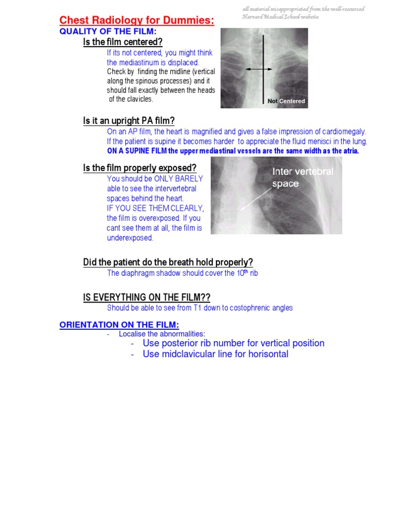Chest Radiology For Dummies Download Free PDF Lung Thorax