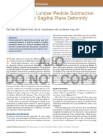 AJO Do Not Copy: Technique For Lumbar Pedicle Subtraction Osteotomy For Sagittal Plane Deformity in Revision