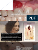 Absceso Periapical 1
