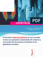 Hipertiroidismo 2021