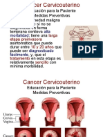 Cancer Cervicouterino prevencion