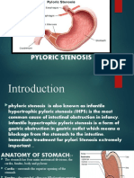 Pyloric Stenosis