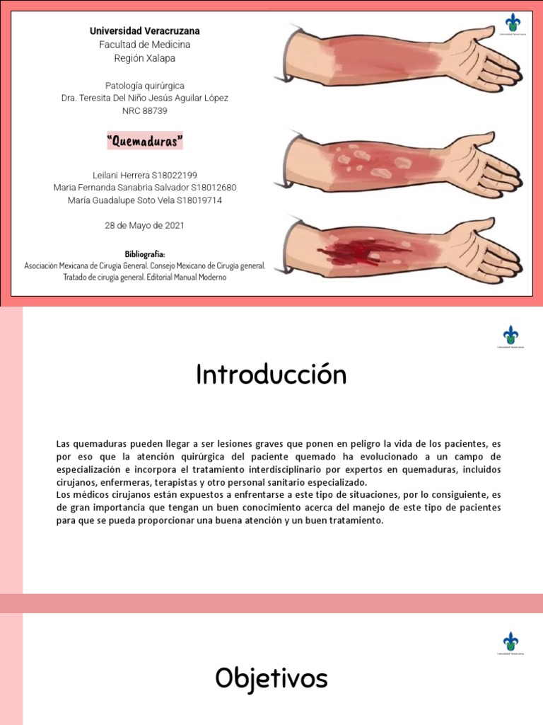 Clasificación y manejo de quemaduras | PDF | Quemar | Herida