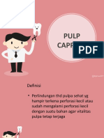 Pulp Capping