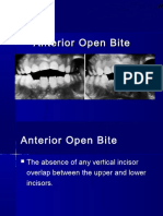 Anterior Open Bite