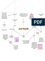 Edema Pulmonar