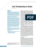 Mechanical Thrombectomy in Stroke: Medicine