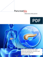 Pancreatitis - Powerpoint Presentation