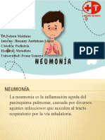 Neumonia S