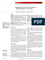 He Anagement F Roantral Communication Ost Dentral Traction: Case Eport