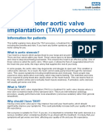 PL - 859.3 - Transcatheter Aortic Valve Implantation (Tavi) Procedure