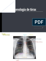 Imagenología Tórax