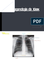 Imagenología Tórax