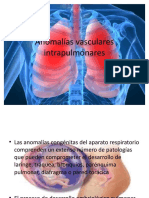 Anomalías vasculares intrapulmónares