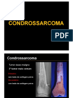 12) Condrossarcoma