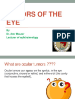 Oculars Tumor