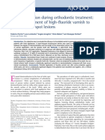 Caries Prevention During Orthodontic Treatment