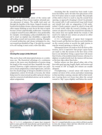 (123doc) Ophthalmic Microsurgical Suturing Techniques Part 2