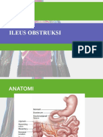 Ileus Obstruksi